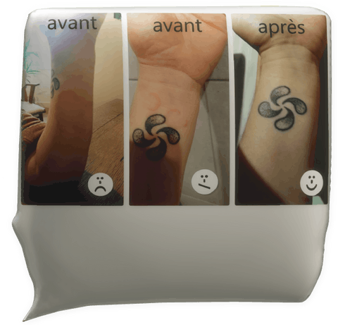 Clic pour agrandir témoignage magnétiseur caroline auffret urticaire chronique avant après