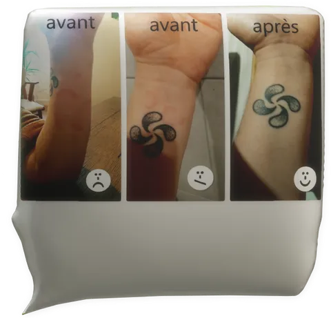 Clic pour agrandir témoignage magnétiseur caroline auffret urticaire chronique avant après