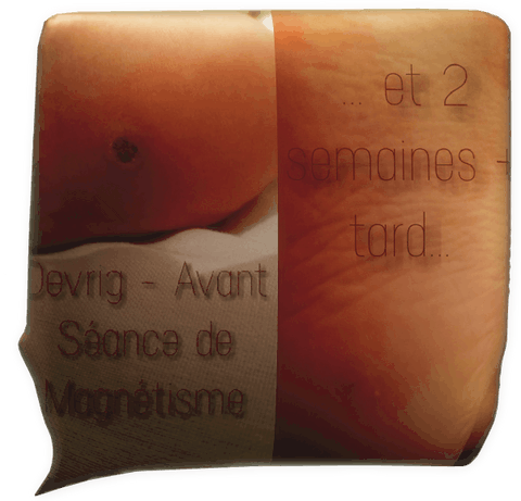 Clic pour agrandir témoignage magnétiseur magnétisme verrue plantaire Dévrig Corbel Sylvie Marrec
