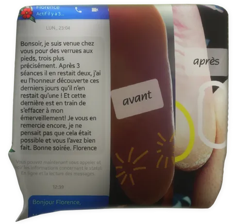 clic pour agrandir témoignage magnétiseur magnétisme verrue plantaire Florence O. L. Pont-Aven