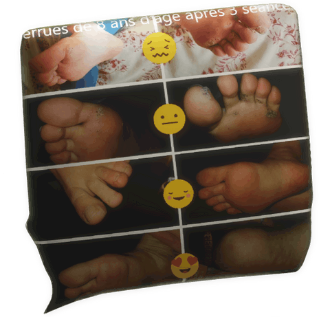 cliquer pour agrandir le commentaire témoignage verrue plantaire Sandra Autret pour Fabrice Corazza magnétiseur guérisseur coupeur de feu Locunolé