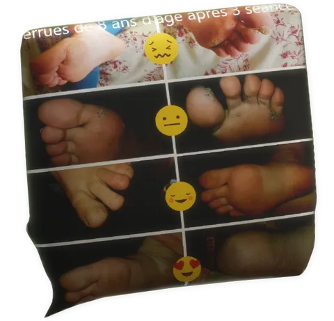 cliquer pour agrandir le commentaire témoignage verrue plantaire Sandra Autret pour Fabrice Corazza magnétiseur guérisseur coupeur de feu Locunolé