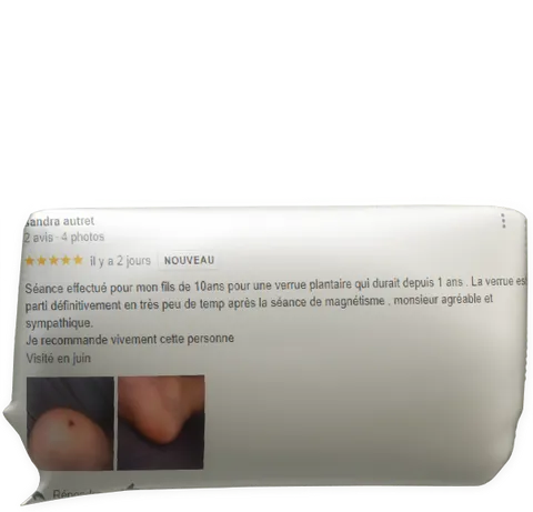cliquer pour agrandir le commentaire témoignage verrue plantaire Sandra Autret pour Fabrice Corazza magnétiseur guérisseur coupeur de feu Locunolé